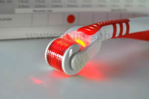 Мезороллер фотонный YYR, 540 игл, Красный свет
