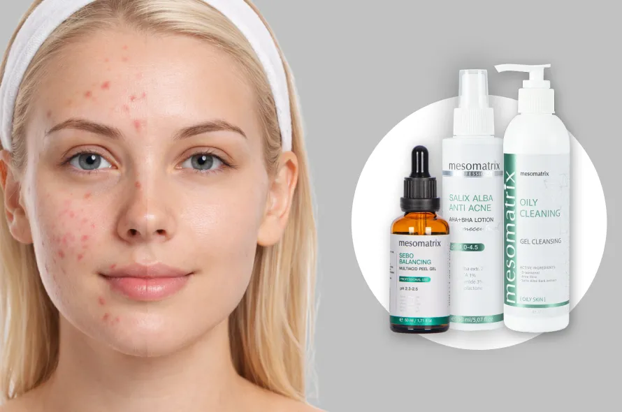 Салициловая кислота_890_590.jpg